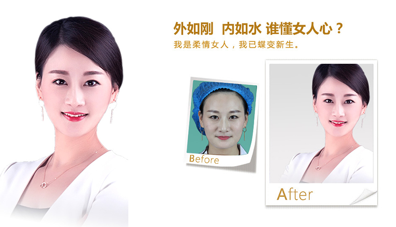 舟山V脸、线雕隆鼻